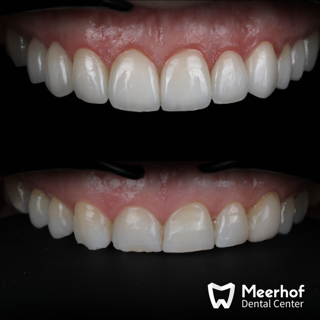 Laminaadid dr.Alexander Savchenko